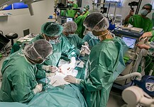 Sikeres volt a fejüknél összenőtt sziámi ikrek plasztikai sebészeti műtéte Budapesten