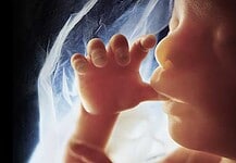 Évente mintegy 700 amerikai nő hal meg terhességgel kapcsolatos okok miatt, kétharmaduk afroamerikai és indián