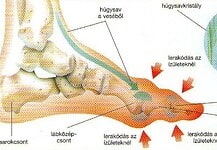 Oldd ki a húgysavat a testrészeidből, hogy megszűnjön a köszvény és az ízületi fájdalom