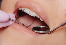 Ezek a tünetek árulják el, hogy álmunkban a fogainkat csikorgatjuk