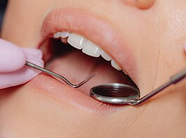 Ezek a tünetek árulják el, hogy álmunkban a fogainkat csikorgatjuk