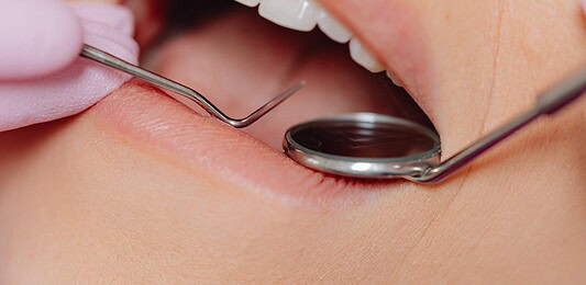 Ezek a tünetek árulják el, hogy álmunkban a fogainkat csikorgatjuk