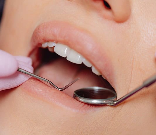 Ezek a tünetek árulják el, hogy álmunkban a fogainkat csikorgatjuk