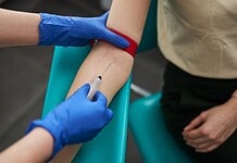 Ezt rontják el a legtöbben vérvétel előtt – félremehet miatta az eredmény