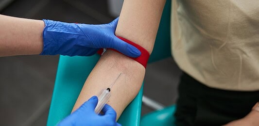 Ezt rontják el a legtöbben vérvétel előtt – félremehet miatta az eredmény